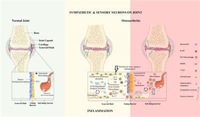 The Neuroimmune Interplay in Joint Pain: The Role of Macrophages